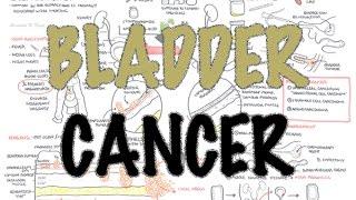 Bladder Cancer - Overview (types, pathophysiology, diagnosis, treatment)