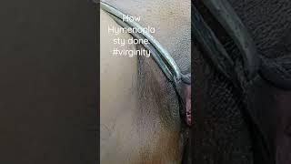 Hymenoplasty, Re-Virgin, Re -seal, First Night Bleeding, first time sex, Safe hymen repair