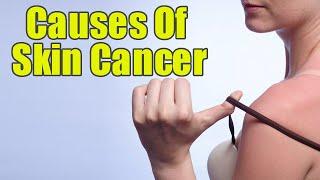 6 Unusual Causes For Skin Cancer You Should Know | Boldsky