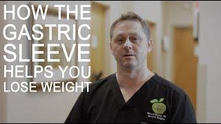 How Gastric Sleeve Surgery Helps you Lose Weight