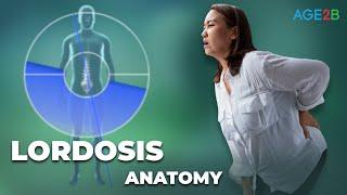 Fast Fix for Lumbar Lordosis | Overview, Symptoms, Causes, Treatment, Prevention And Diagnosis