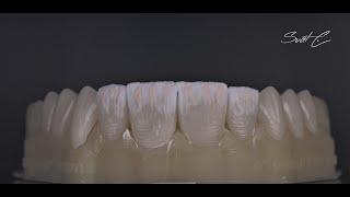 IPS E.max ceram porcelain minimal Build up , e.max CAD , e.max cut-back , ivoclar vivadent