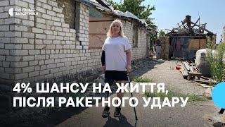Історія жительки Зарічного на Запоріжжі, яка пережила ампутацію внаслідок обстрілу РФ