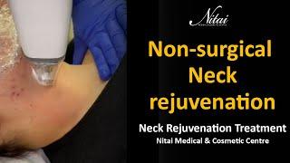 Neck Rejuvenation Treatment | Nitai Medical & Cosmetic Centre | Melbourne