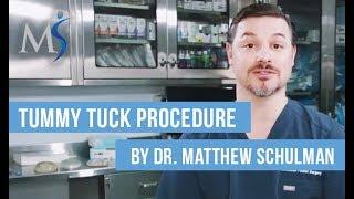 Tummy Tuck - Matthew Schulman, M.D. - Schulman Plastic Surgery