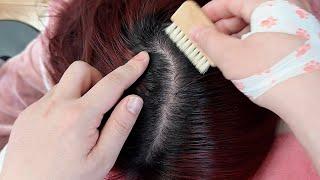 ASMR Ultimate Scalp Care: Comb, Tweezers, and Brush for Dandruff Removal