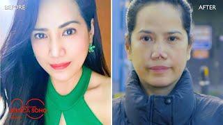 Pinay OFW, nag-agaw buhay matapos maimpeksyon ang ipinaretokeng ilong | Kapuso Mo, Jessica Soho