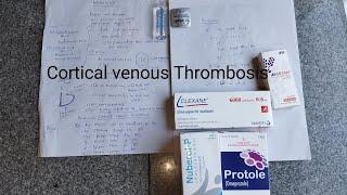 Cortical venous Thrombosis very important lec