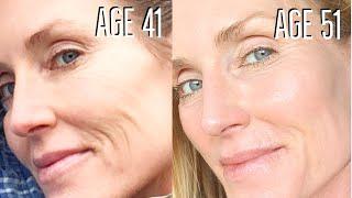 MICRONEEDLING AT HOME- WHAT IT DOES + DEMO & TIPS//BEFORE and AFTER 10 YEARS  of DIY DERMA-ROLLING