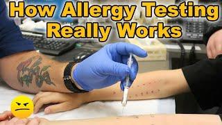 HOW TESTING FOR ALLERGIES REALLY WORKS