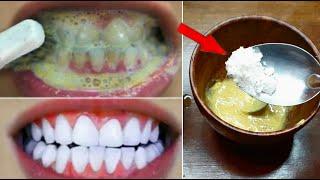 This method will make white and white-white yellowing such as milk in 3 minutes. Whitening teeth