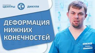  Деформация стопы - что делать, как исправить? Отвечает ортопед. Деформация стопы что делать. 12+