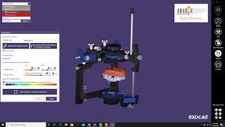 Virtual Articulator -Dr. Adarve