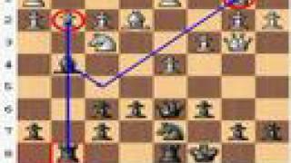 Chess Expert vs Chess Master (Caro-Kann Defense, Bronstein-Larsen)