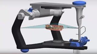 3Shape TRIOS Design Studio - Dynamic Virtual Articulator