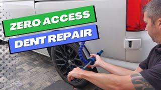 Zero Access Dent Repair | Paintless Dent Removal