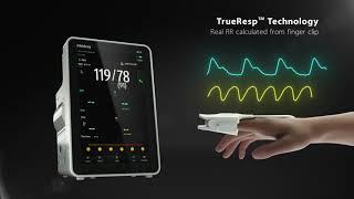Neue Generation: Vitalparameter Monitore von Mindray
