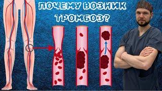 ПОЧЕМУ ВОЗНИК ТРОМБОЗ? КАК ЕГО ЛЕЧИТЬ?