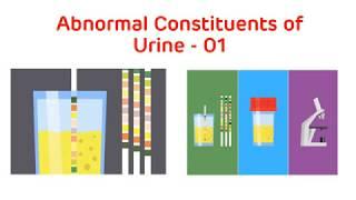 Analysis of Abnormal Urine || Abnormal Urine Constituents Practical Part I || Biochemistry Practical