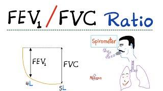 FEV1/ FVC Ratio - Pulmonary Medicine - Obstructive VS Restrictive Lung Disease - Respiratory Physio