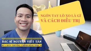 Ngón tay lò xo là gì?các đối tượng hay gặp phải và các phương pháp điều trị 0898313122 (sms/zalo)