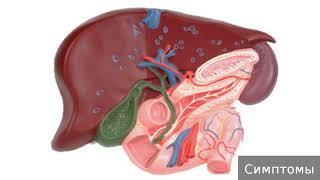 Хронический холецистит. Как лечить хронический холецистит.