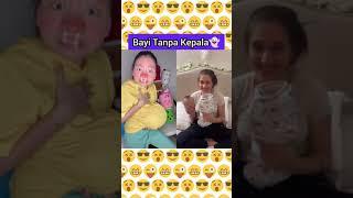 Kepala Bayi Copot ! Mama Tolong #shorts Nasya kaila nazifah