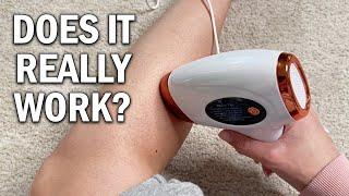 Aopvui IPL Hair Removal Device Review - Does It Really Work?