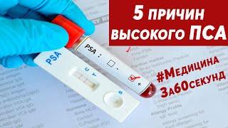 Причины высокого ПСА | Почему повышается ПСА? | Что такое ПСА? | #МедицинаЗа60секунд