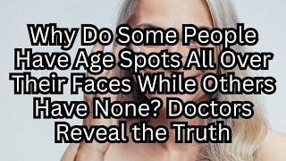 Why Do Some People Have Age Spots All Over Their Faces While Others don't? Doctors Reveal the Truth