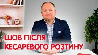 КЕСАРЕВО СЕЧЕНИЕ: ШОВ и БОЛЬ после операции