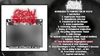 Organ Failure - Neurologic Determination of Death FULL ALBUM (2022 - Goregrind)