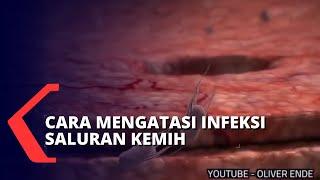 Hati-hati dengan Infeksi Saluran Kemih!