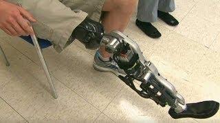 Bionic leg can 'read' brain signals to walk