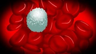 Что такое лейкоз, какие признаки и как самостоятельно обнаружить лейкоз крови?