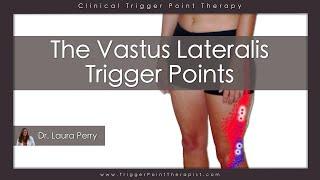The Vastus Lateralis Trigger Points