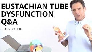 Q&A ETD - Eustachian Tube Dysfunction - Other remedies to try