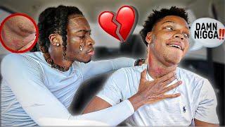 “HICKEY PRANK”🫦ON BOYFRIENDWITH A TWIST