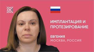 Имплантация и протезирование: из Москвы в Минск