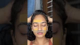 Get rid of acne overnight| Band aid hack for acne | Does it work? #acnetreatment #acne  #skincare