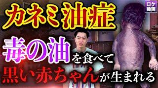 【カネミ油症事件】黒い赤ちゃんが産まれる…戦後最大の食品公害を現地からわかりやすく解説