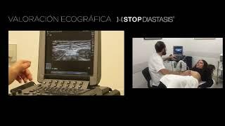 Evaluation Ultrasound of diastasis of rectus abdominis