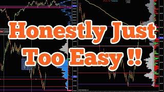 How to Grow $400 Micro Emini S&P 500 Account Trading Supply and Demand Zones (MES)