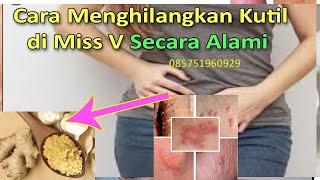 Cara Menghilangkan Kutil di Miss V Secara Alami - Obat Kutil Kelamin Herbal === 085741891390