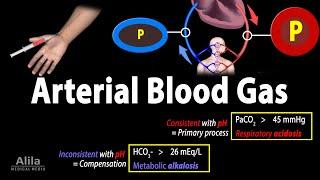 Arterial Blood Gas (ABG) Test, Animation