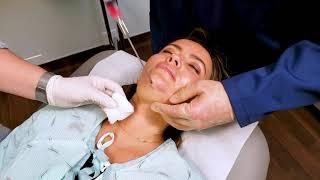 In Office Chin Liposuction