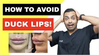 Avoiding DUCK LIPS: Causes of LIP FILLER MIGRATION!