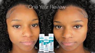 Watch this before using CeraVe Resurfacing Retinol Serum | 1 year review | Mini Q&A | Does it work?
