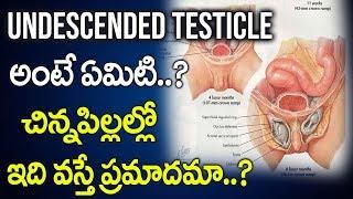 What are Undescended Testicles..? | Cryptorchidism | What causes undescended testes in a child..?