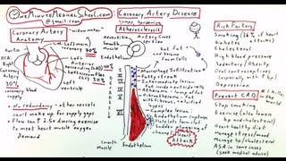 Coronary Artery Disease: Cause of Heart Attack - One Minute Medical School